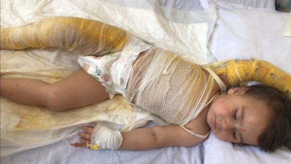2 yaşındaki bebek sıcak su dolu kovaya düştü