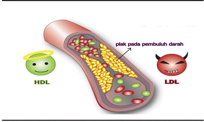 HDL Kolestrol Düşüklüğü Nedir ve Nasıl Düzelir?