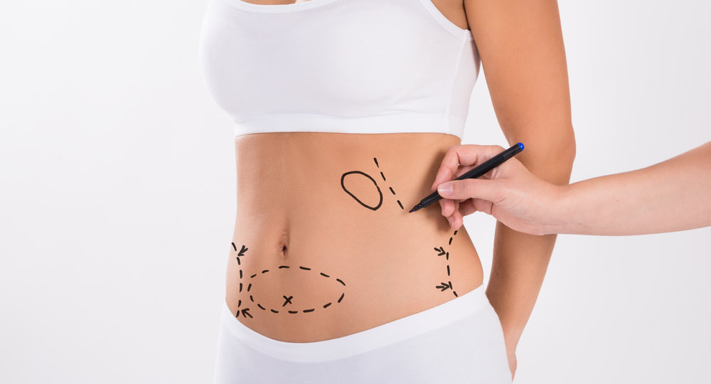 Vaser Liposuction ile Klasik Liposuction Arasında Fark Var Mı?